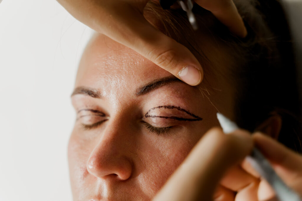 Chirurgie des paupières